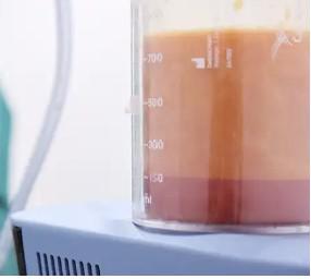 ดูดไขมัน liposuction ดูดไขมันหน้าท้อง เอว s ดูดไขมันเหนียง j-plasma ulthera 